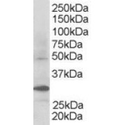 abx432681 staining (0.3 µg/ml) of Human Kidney lysate (RIPA buffer, 30 µg total protein per lane). Primary incubated for 1 hour. Detected by western blot using chemiluminescence.