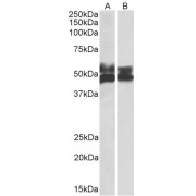 abx432683 (0.5 µg/ml) staining of Human Tonsil (A) and Thymus (B) lysates (35 µg protein in RIPA buffer). Primary incubation was 1 hour. Detected by chemiluminescence.