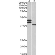 abx432684 (0.3 µg/ml) staining of Human Heart (A) and Liver (B) lysates (35 µg protein in RIPA buffer). Primary incubation was 1 hour. Detected by chemiluminescence.