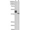 Fc Receptor-Like Protein 1 (FCRL1) Antibody