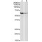Fc Receptor-Like Protein 2 (FCRL2) Antibody