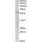 Fibronectin Type III And SPRY Domain Containing 1 (FSD1) Antibody