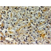 Immunohistochemistry analysis of paraffin-embedded Human Liver using Ferritin, Heavy Polypeptide 1 (FTH1) Antibody (2 µg/ml). Steamed antigen retrieval with citrate buffer pH 6, HRP-staining.