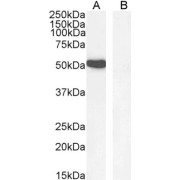 abx432733 (1 µg/ml) staining of K562 nuclear cell lysate (A) and negative control Human Hippocampus (B) lysate (35 µg protein in RIPA buffer). Detected by chemiluminescence.