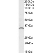 abx432737 (0.1 µg/ml) staining of Human Prostate lysate (35 µg protein in RIPA buffer). Detected by chemiluminescence.