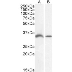 Growth Differentiation Factor 15 (GDF15) Antibody