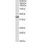 Aspartate Aminotransferase, Mitochondrial (GOT2) Antibody