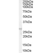 abx432767 (0.01 µg/ml) staining of Human Breast lysate (35 µg protein in RIPA buffer). Primary incubation was 1 hour. Detected by chemiluminescence.