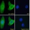 Glutathione S Transferase Mu 3 (GSTM3) Antibody