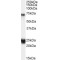 Huntingtin Associated Protein 1 (HAP1) Antibody