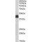 HLA class I histocompatibility antigen, B alpha chain (HLA-B) Antibody