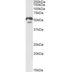 Hepatocyte Nuclear Factor 4 Alpha (HNF4A) Antibody