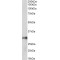 Homeobox Protein Hox-A5 (HOXA5) Antibody