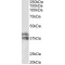 Haptoglobin Beta Chain (HP) Antibody