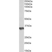 abx432822 (1 µg/ml) staining of Human Cerebellum lysate (35 µg protein in RIPA buffer). Primary incubation was 1 hour. Detected by chemiluminescence.