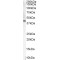 3 Beta-Hydroxysteroid Dehydrogenase/Delta 5-->4-Isomerase Type 1 (HSD3B1) Antibody