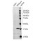 Isocitrate Dehydrogenase 1, Soluble (IDH1) Antibody