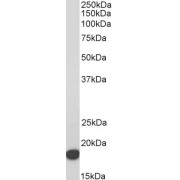 abx432840 (1 µg/ml) staining of HeLa lysate (35 µg protein in RIPA buffer). Detected by chemiluminescence.