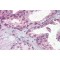 Interferon Alpha/Beta Receptor 2 (IFNAR2) Antibody