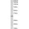 Insulin Like Growth Factor Binding Protein 1 (IGFBP1) Antibody