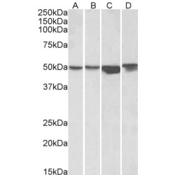 Integrin-Linked Protein Kinase (ILK) Antibody