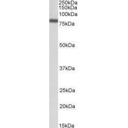 Interferon Regulatory Factor 2 Binding Protein 1 (IRF2BP1) Antibody