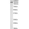 Inter-Alpha-Trypsin Inhibitor Heavy Chain H4 (ITIH4) Antibody