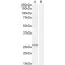 Kallikrein 2 (KLK2) Antibody