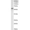 Phosphatidylcholine-Sterol Acyltransferase (LCAT) Antibody