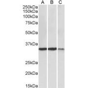 abx432921 (0.3 µg/ml) staining of Heart (A), Skeletal Muscle (B) and Kidney (C) lysates (35 µg protein in RIPA buffer). Primary incubation was 1 hour. Detected by chemiluminescence.