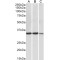 Lactate Dehydrogenase A (LDHA) Antibody