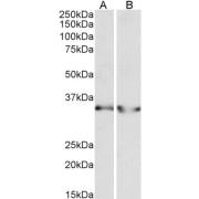 abx432922 (0.3 µg/ml) staining of Human Heart (A) and Human Kidney (B) lysates (35 µg protein in RIPA buffer). Primary incubation was 1 hour. Detected by chemiluminescence.