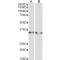 Lactate Dehydrogenase B (LDHB) Antibody