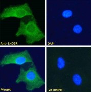 abx432925 Immunofluorescence analysis of paraformaldehyde fixed HeLa cells, permeabilized with 0.15% Triton. Primary incubation 1hr (10 µg/ml) followed by AF488 secondary antibody (2 µg/ml), showing plasma membrane staining. The nuclear stain is DAPI (blue). Negative control: Unimmunized goat IgG (10 µg/ml) followed by AF488 secondary antibody (2 µg/ml).