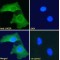 Luteinizing Hormone/Choriogonadotropin Receptor (LHCGR) Antibody