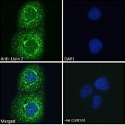 Immunofluorescence analysis of paraformaldehyde fixed A431 cells, permeabilized with 0.15% Triton. Primary incubation 1hr (10 µg/ml) followed by AF488 secondary antibody (2 µg/ml), showing cytoplasmic staining. The nuclear stain is DAPI (blue). Negative control: Unimmunized goat IgG (10 µg/ml) followed by AF488 secondary antibody (2 µg/ml).