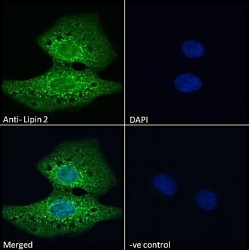 Lipin 2 (LPIN2) Antibody