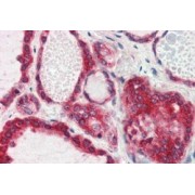 abx432932 (2.5 µg/ml staining of paraffin embedded Human Thyroid Gland. Steamed antigen retrieval with citrate buffer pH 6, AP-staining.