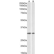 abx432943 (0.5 µg/ml) staining of Human Heart (A) and Placenta (B) lysates (35 µg protein in RIPA buffer). Primary incubation was 1 hour. Detected by chemiluminescence.