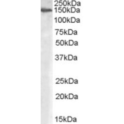 Alpha-Mannosidase 2 (MAN2A1) Antibody