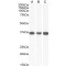 Malate Dehydrogenase 2 (MDH2) Antibody