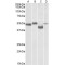 Meis Homeobox 2 (MEIS2) Antibody