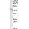 Matrix Metalloproteinase 12 (MMP12) Antibody