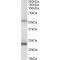 Matrix Metalloproteinase 3 / Stromelysin-1 (MMP3) Antibody