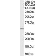 abx432976 (0.03 µg/ml) staining of Human Breast lysate (35 µg protein in RIPA buffer). Primary incubation was 1 hour. Detected by chemiluminescence.