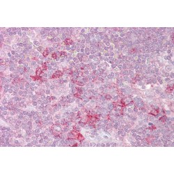 Serine/Threonine-Protein Kinase 26 (STK26) Antibody