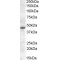 Melatonin Receptor 1A (MTNR1A) Antibody