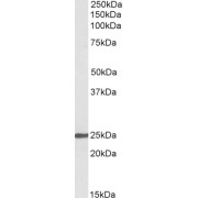 abx433015 (0.1 µg/ml) staining of Kelly lysate (35 µg protein in RIPA buffer). Primary incubation was 1 hour. Detected by chemiluminescence.