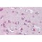 Neurofibromin 2 (NF2) Antibody