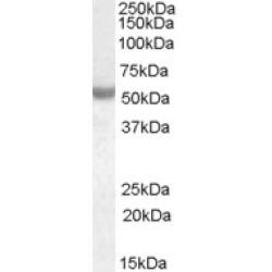 Neuro Oncological Ventral Antigen 1 (NOVA1) Antibody